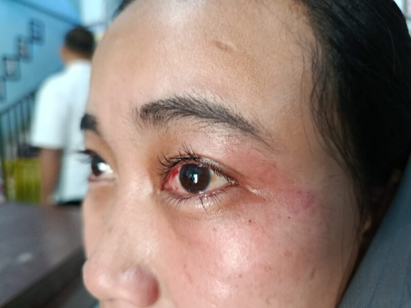 Siti Sufian Laporkan, Sepupunya ke polres Pamekasan: Sertifikat Tanah Berujung Penganiayaan
