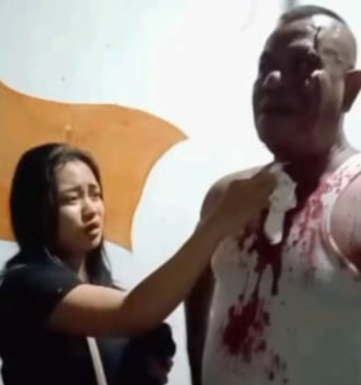 Kasus Premanisme di Cafe, Edelweis Mulai Disidangkan di PN Bangil, Korban Minta Pelaku Dihukum Berat