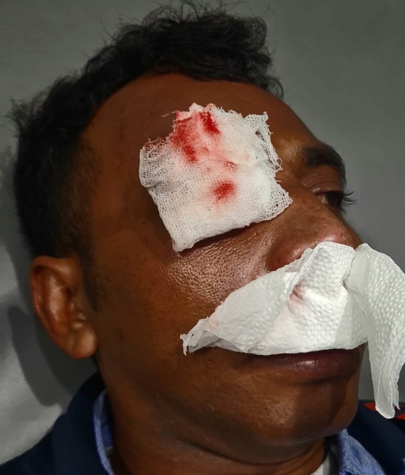 Viral Surabay Biknis Lendir, Sewa Premanisme Segera di Segel N Grebek