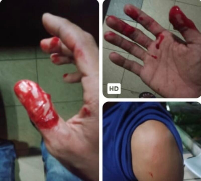 Kasus Penganiayaan, di Cafe Golden Memory Dilaporkan ke Polisi, Korban Alami Luka Serius