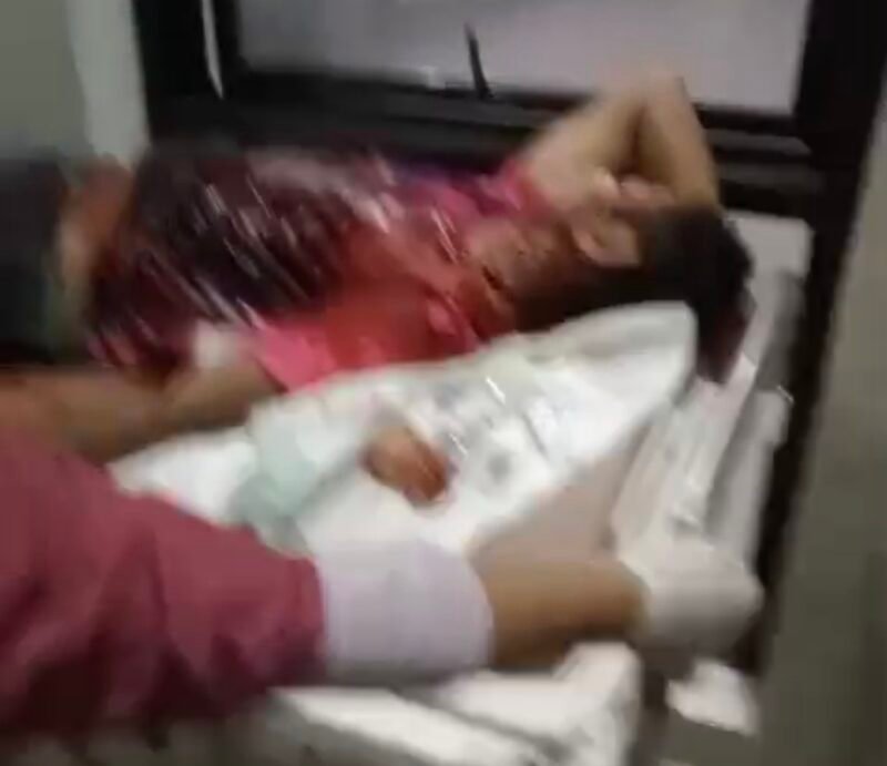 Foto: Pria di Camplong Diserang Clurit, Luka Parah di Kepala dan Lengan