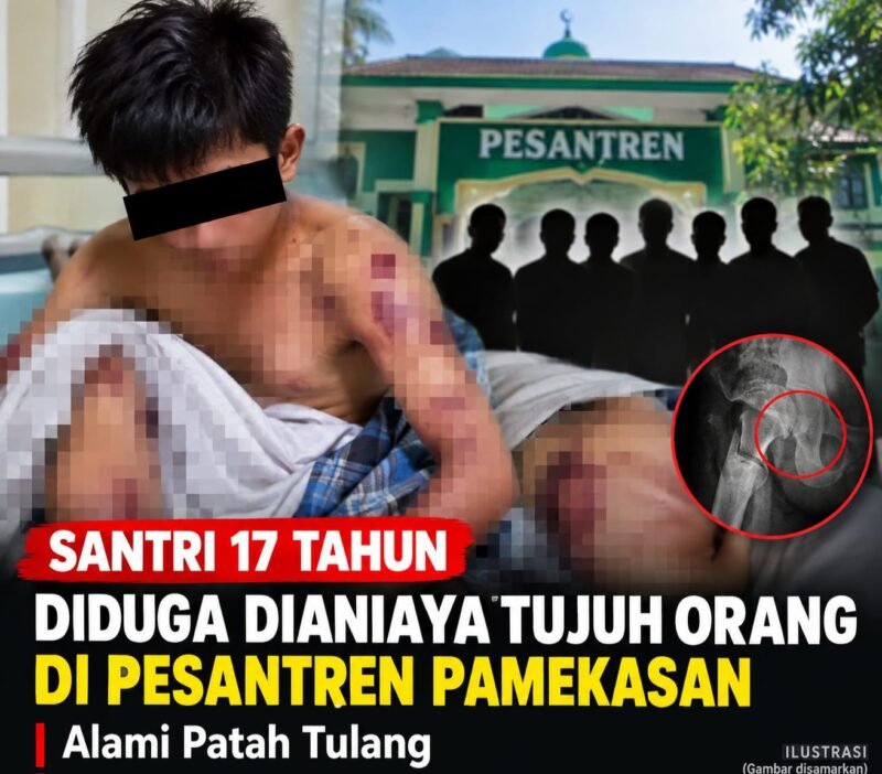 Santri 17 Tahun Diduga Dianiaya Tujuh Orang di Pesantren Pamekasan, Alami Patah Tulang
